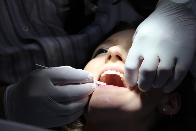 zub,  zuby,  zubař,  zubní kaz,  prohlídka,  lékař,  ústa | foto: CC0 Creative Commons,  Fotobanka Pixabay,  CC0 1.0
